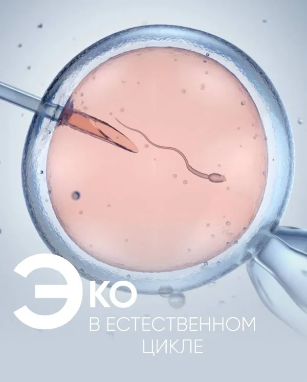 ЭКО в естественном цикле: кому подойдёт такой подход?