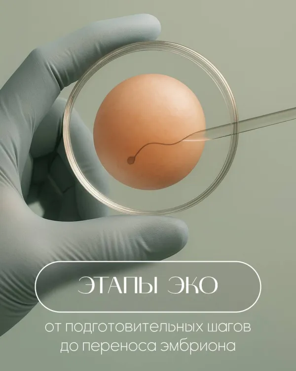 Этапы ЭКО-процедуры: от подготовительных шагов до переноса эмбриона